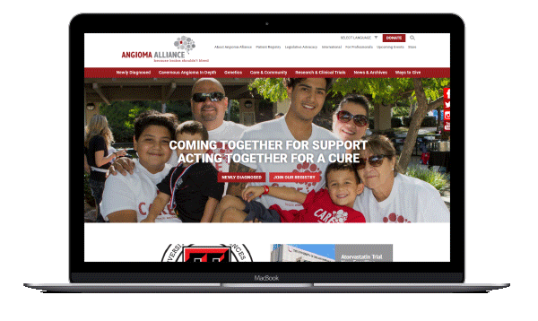 Angioma To Cure scrolling on laptop